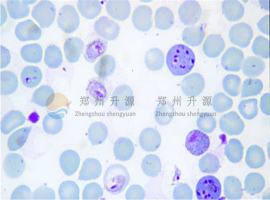 溶組織阿米巴切片